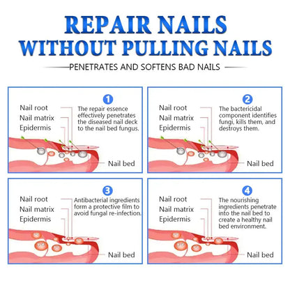 Get Clear, Healthy Nails in Just 7 Days – 100% Plant-Based Extra Strength Liquid
