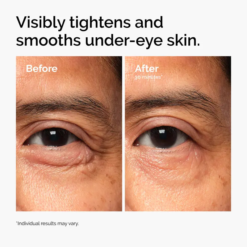 Advanced PDRN Firming & Brightening Eye Cream | Buy 2 Get 1 Free