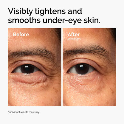 Advanced PDRN Firming & Brightening Eye Cream | Buy 2 Get 1 Free