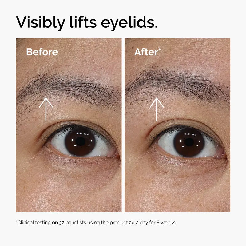 Advanced PDRN Firming & Brightening Eye Cream | Buy 2 Get 1 Free