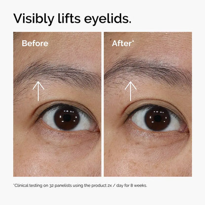 Advanced PDRN Firming & Brightening Eye Cream | Buy 2 Get 1 Free