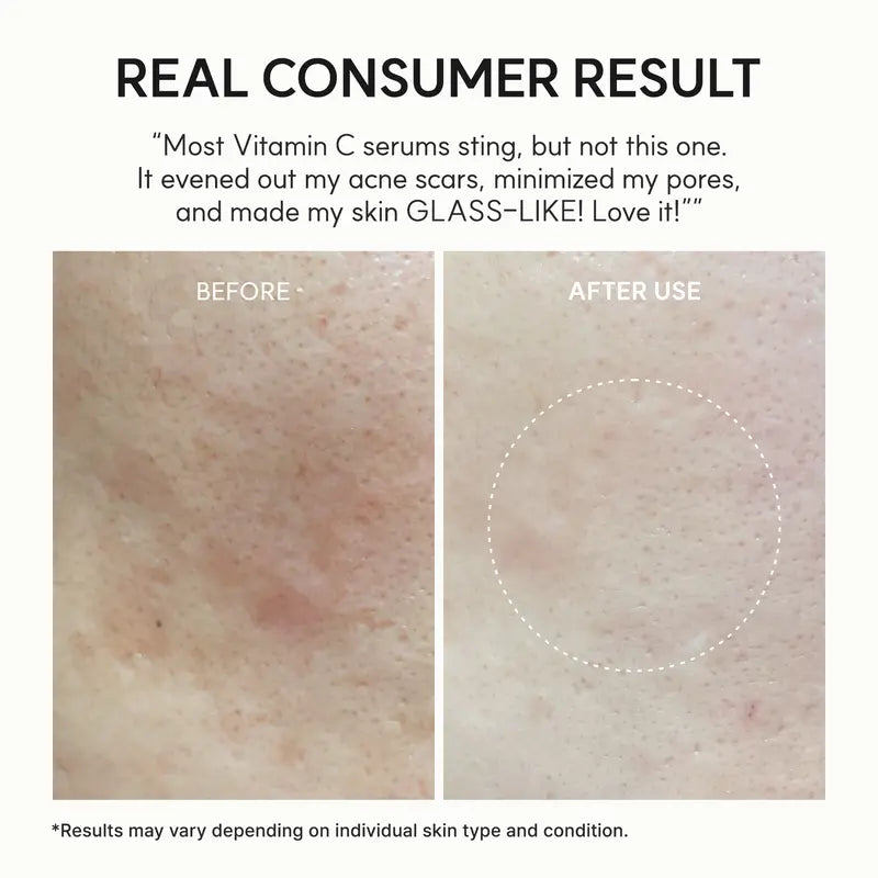 Vitamin C + Glutathione Glow Booster