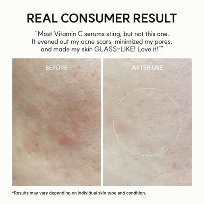 Vitamin C + Glutathione Glow Booster